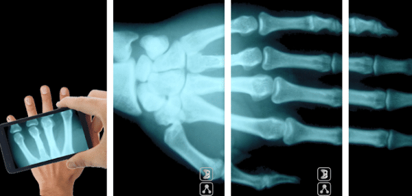 X-Ray Scan Prank